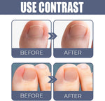 Charger l'image dans la galerie, Sérum pour la réparation des ongles en 2 semaine