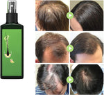 Charger l'image dans la galerie, 2 Spray Anti-Chute pour la Croissance Rapide et la Réparation des Cheveux