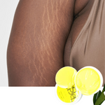 Charger l'image dans la galerie, Crème Anti-vergetures pour Femmes et Hommes