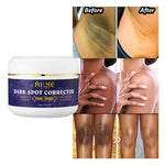 Charger l'image dans la galerie, Correcteur de Taches Foncées en 7 jours