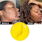 Charger l'image dans la galerie, Savon Naturel au Ginseng pour HOMMES et FEMMES pour une Peau Éclatante et Saine