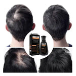 Charger l'image dans la galerie, Shampoing à la Biotine pour la Croissance des Cheveux pour Hommes et Femmes