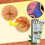 Charger l'image dans la galerie, Crème contre les hémorroïdes pour Hommes et Femmes