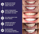 Charger l'image dans la galerie, BLANCHIMENT DES DENTS PROFESSIONNELS