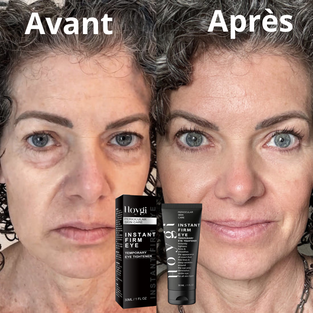 2 Boîtes de Crèmes contre les poches des yeux et rides pour Hommes et Femmes